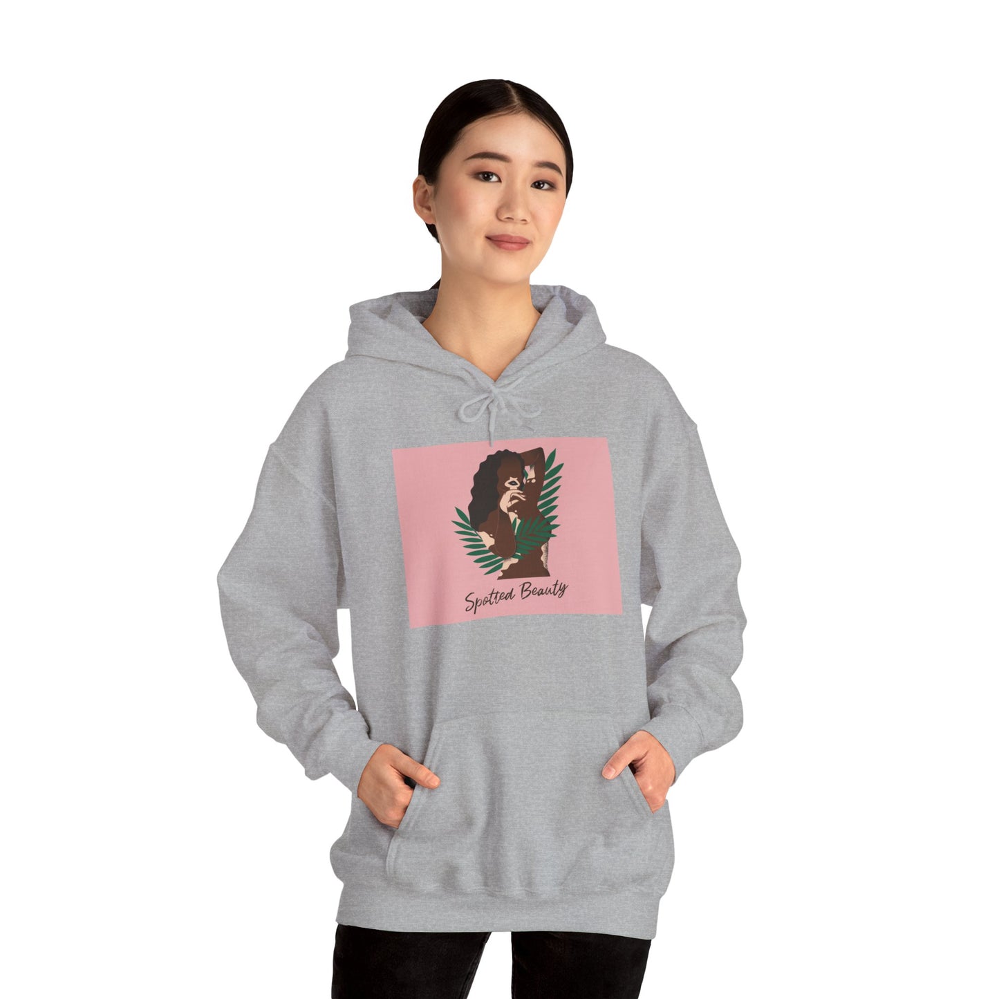 Vitiligo is Beautiful Hoodie —  Graphic Hooded Sweatshirt