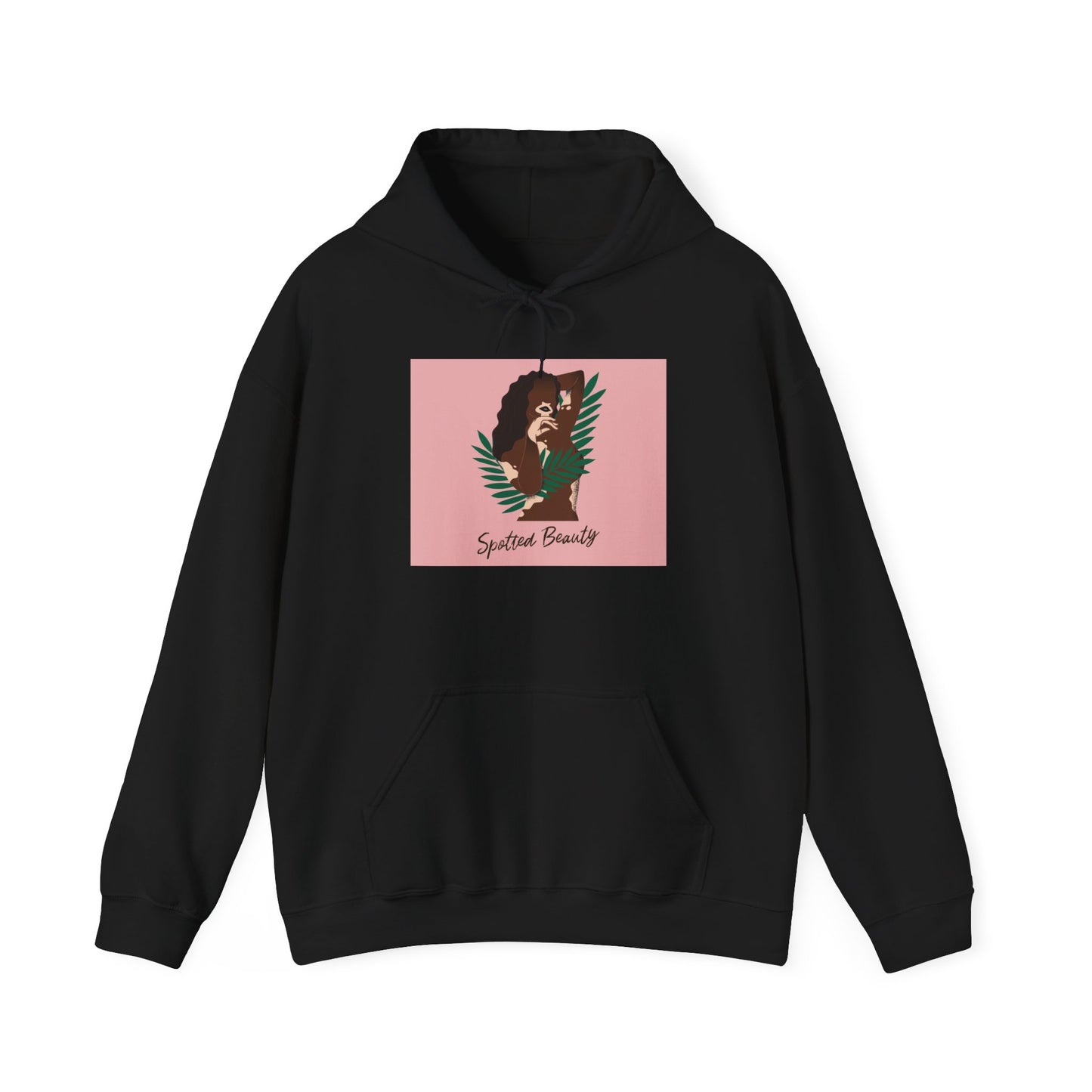 Vitiligo is Beautiful Hoodie —  Graphic Hooded Sweatshirt