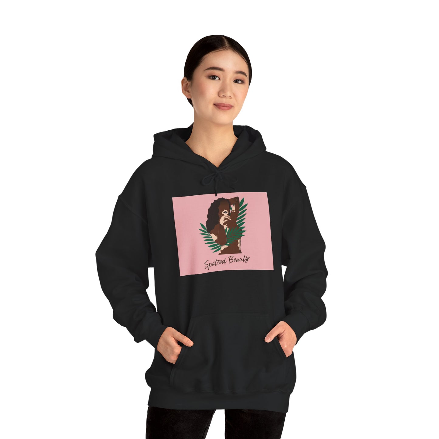 Vitiligo is Beautiful Hoodie —  Graphic Hooded Sweatshirt