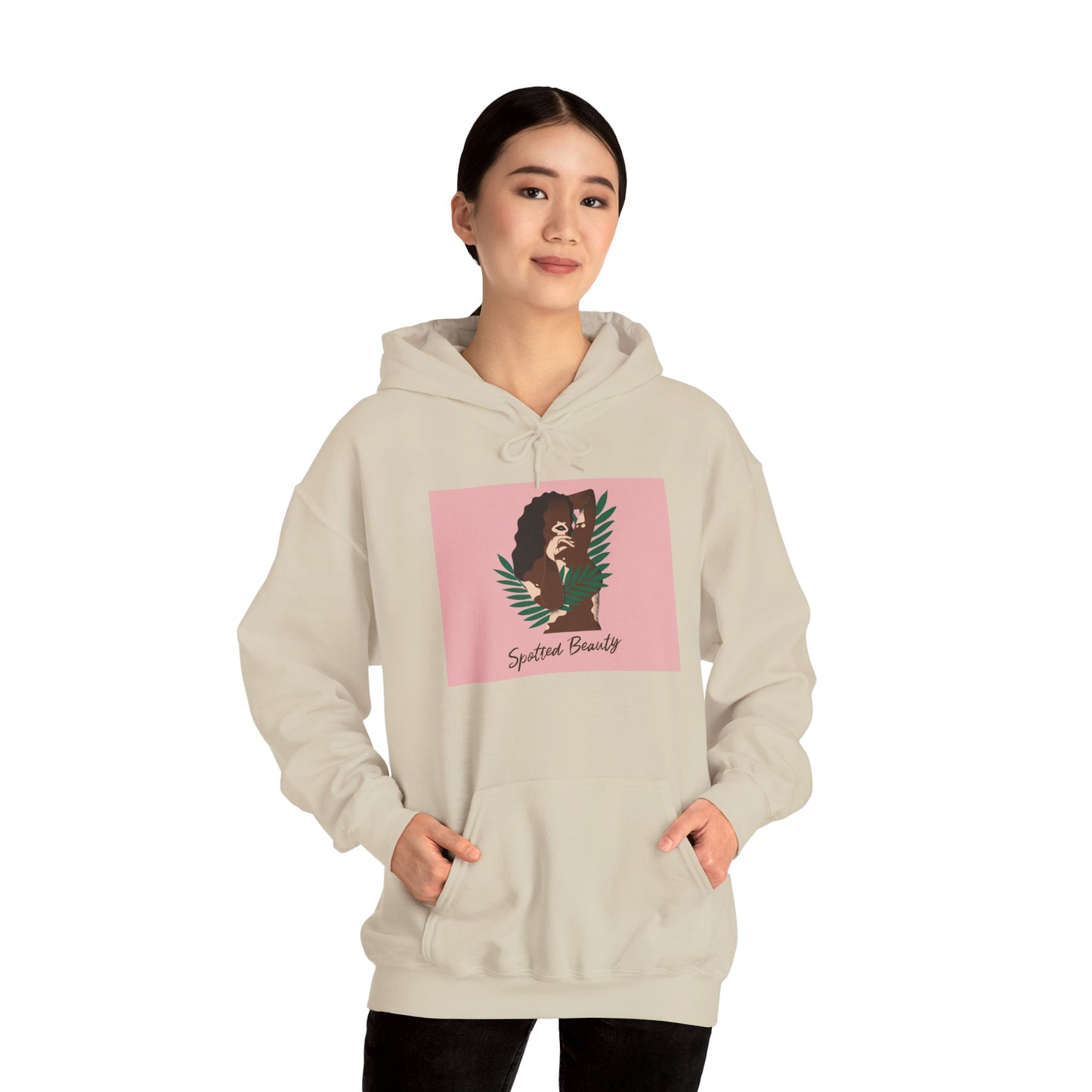 Vitiligo is Beautiful Hoodie —  Graphic Hooded Sweatshirt