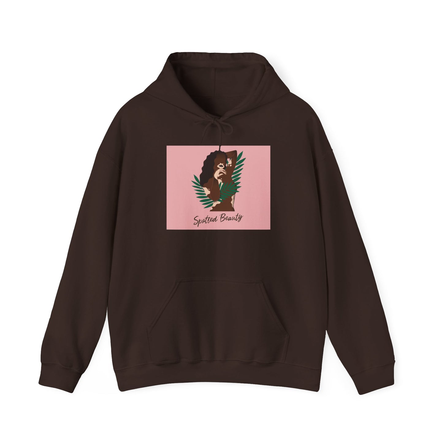 Vitiligo is Beautiful Hoodie —  Graphic Hooded Sweatshirt